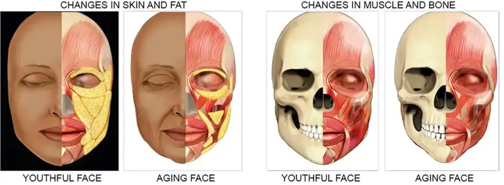 Changes in skin and fat.