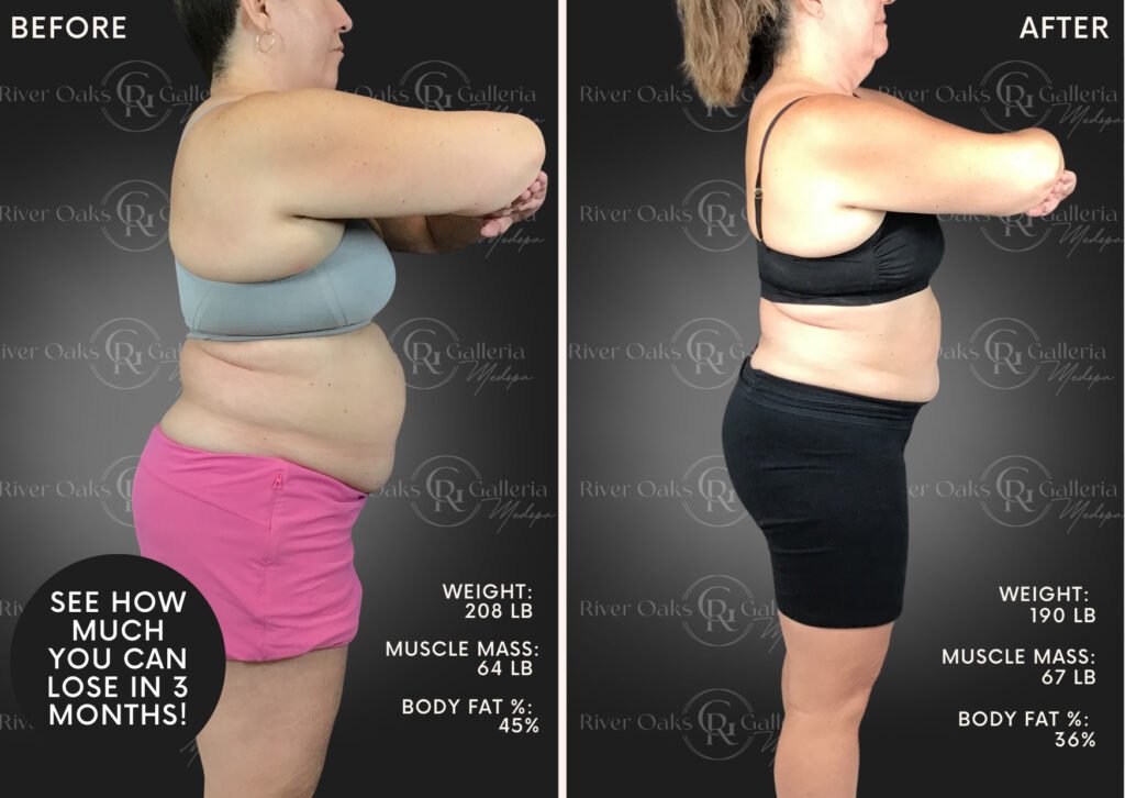 Lose weight and improve muscle tone with ROG Transform Houston, TX.