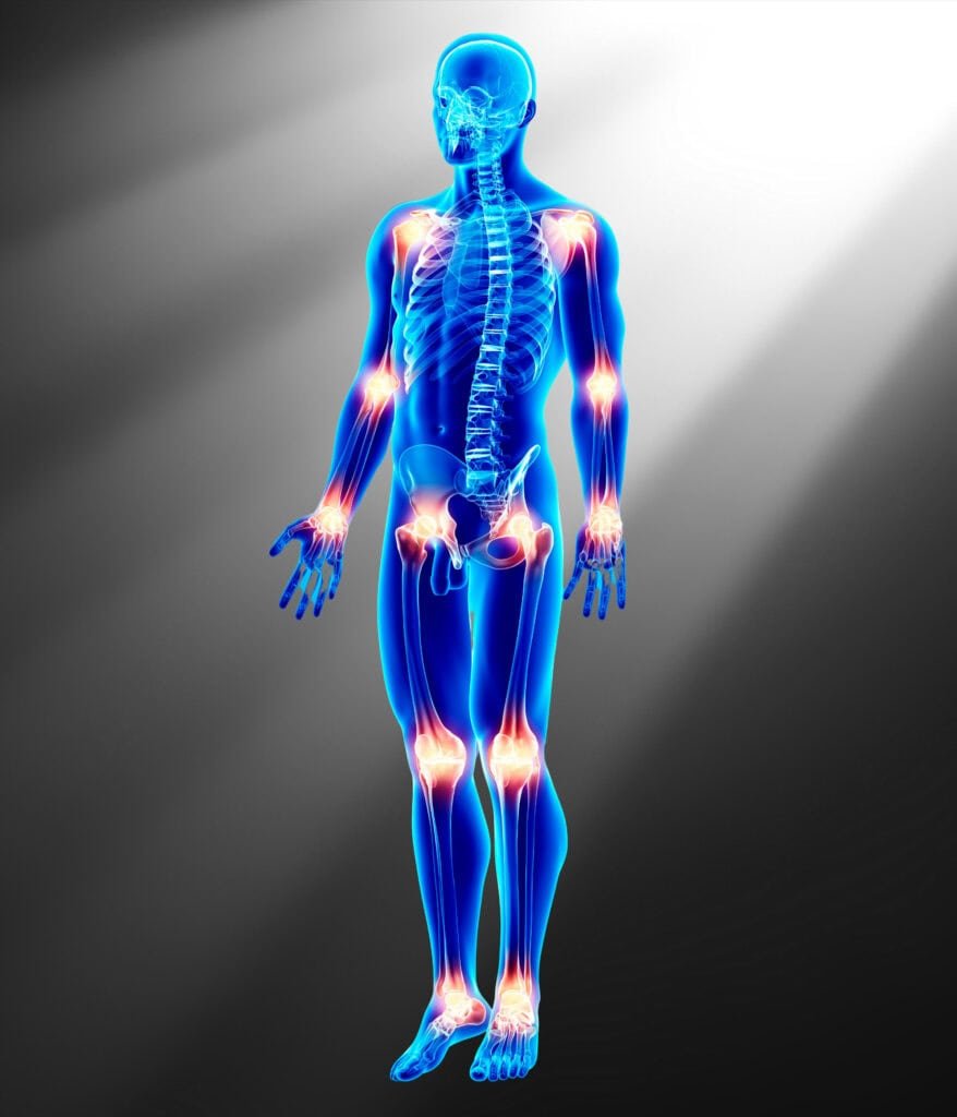 Human skeletal system highlighting joints in red and orange.