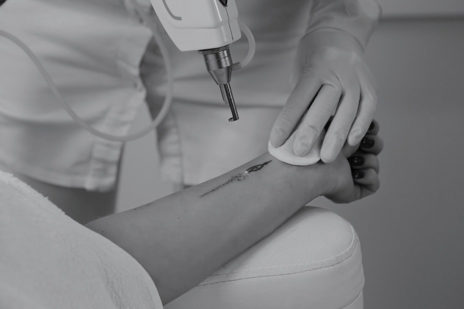 Laser Tattoo Removal Houston - doing laser tattoo removal from woman hand in medspa