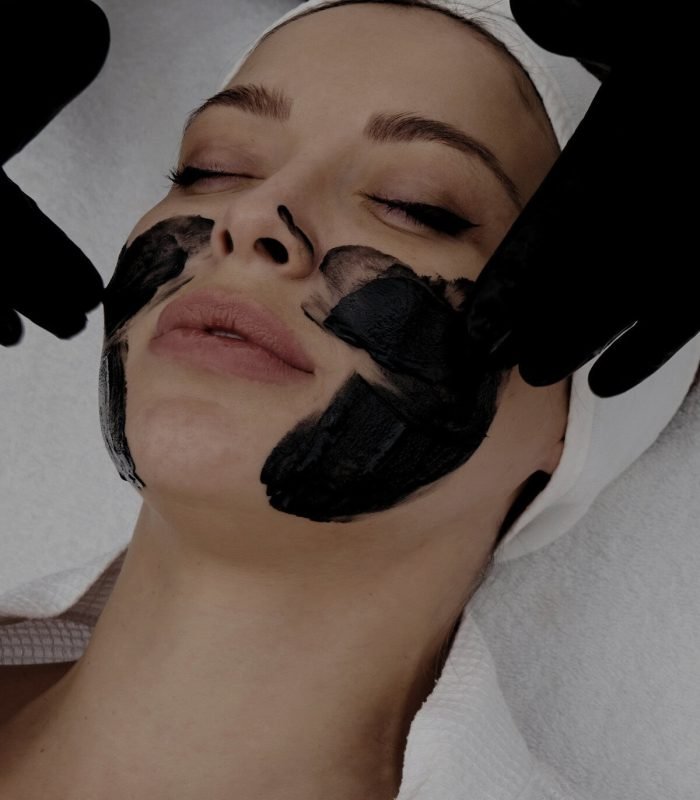Hollywood laser peel
